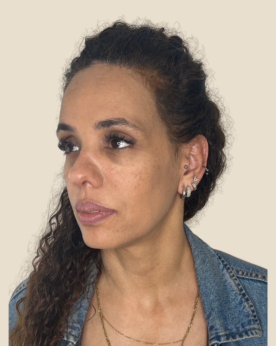 אחרי הטיפול