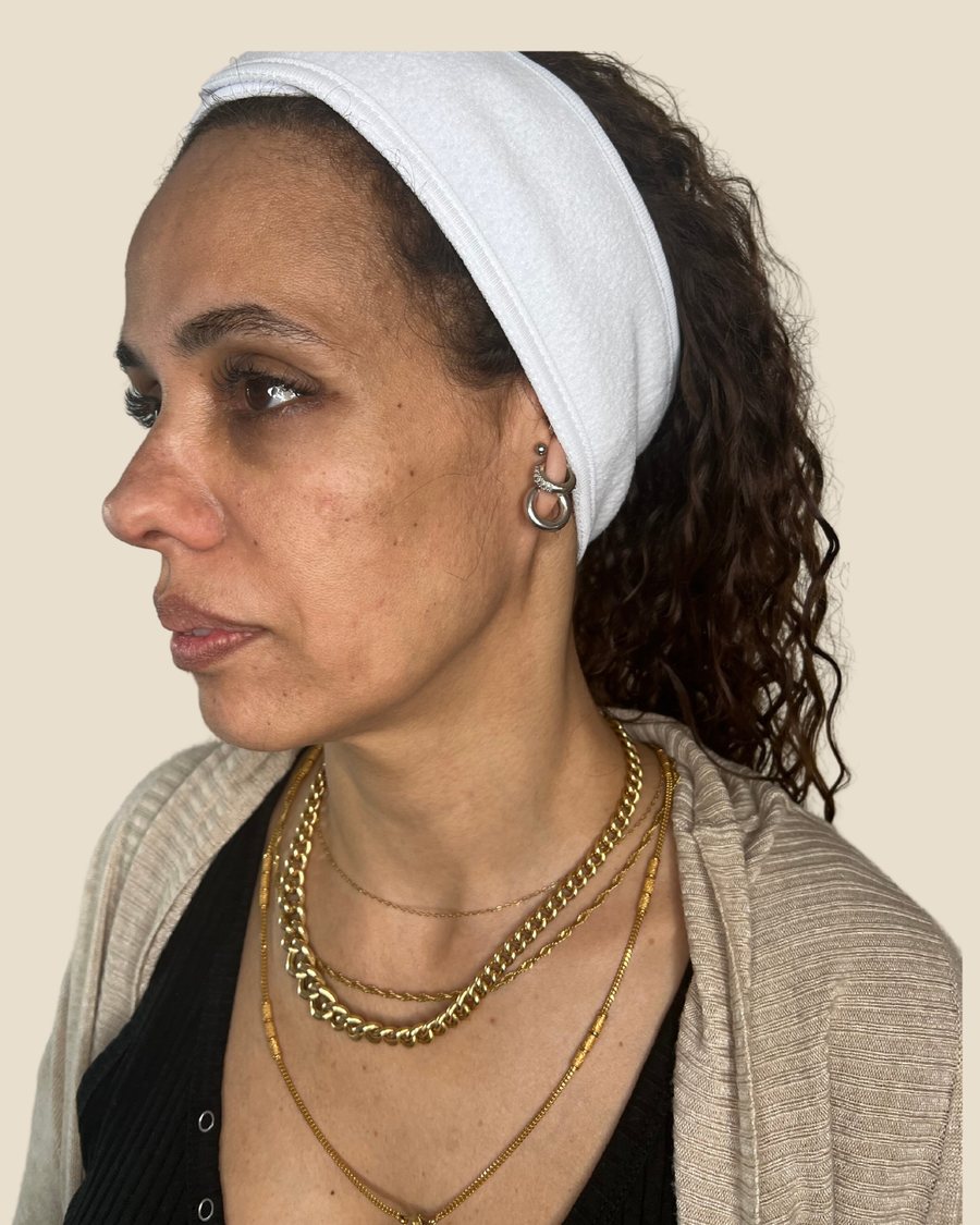 לפני הטיפול