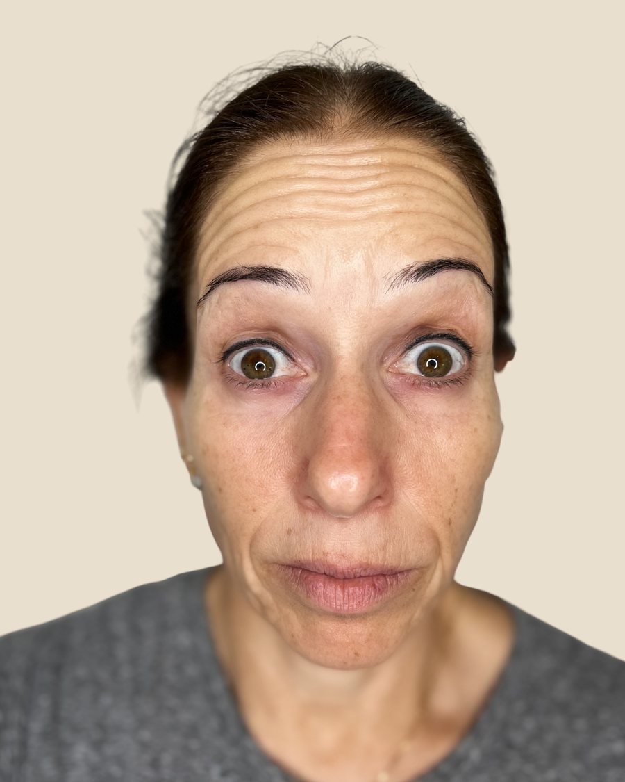לפני הטיפול