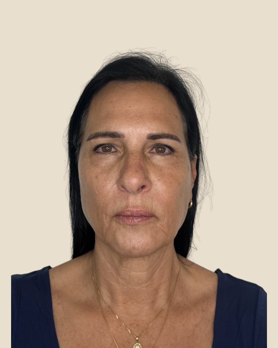 אחרי הטיפול