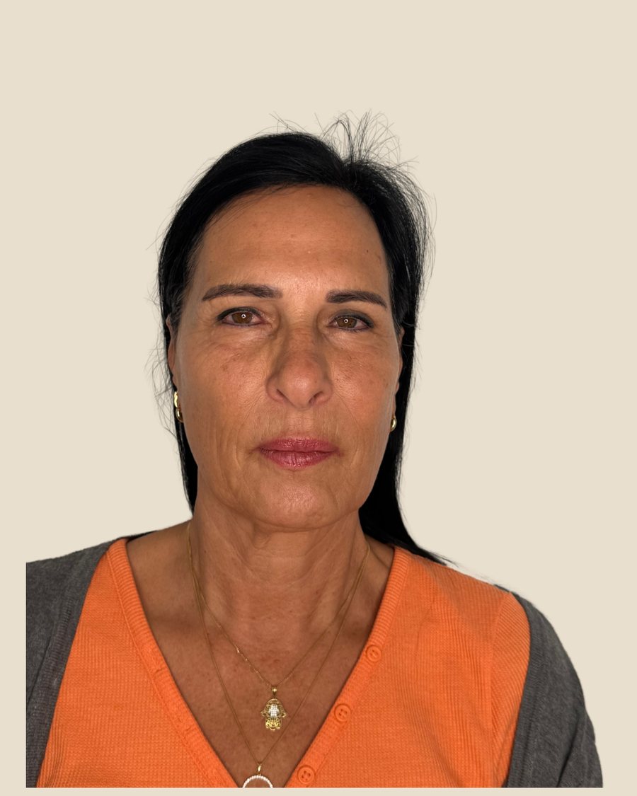 לפני הטיפול