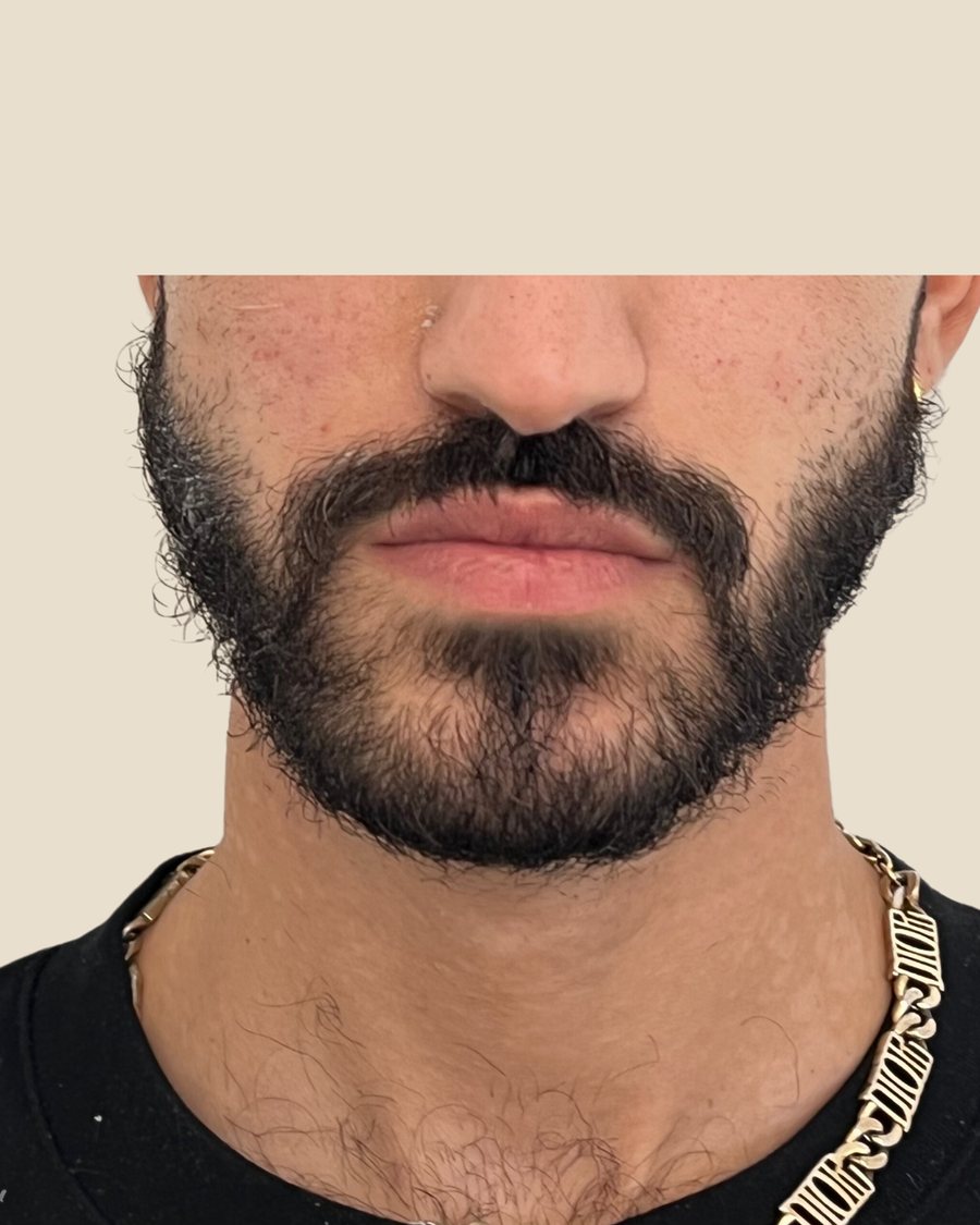 אחרי הטיפול
